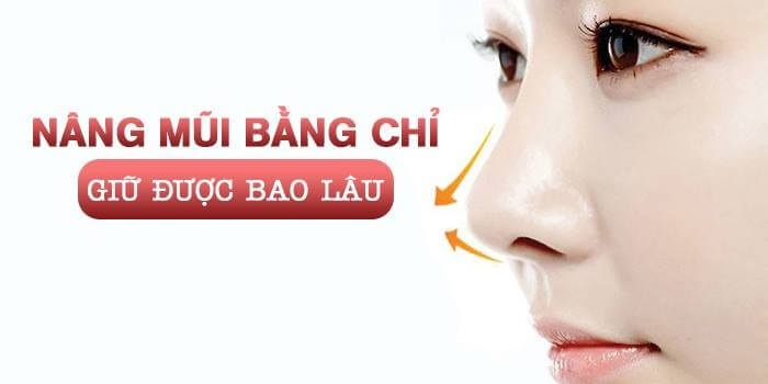 Phương pháp nâng mũi bằng chỉ collagen 